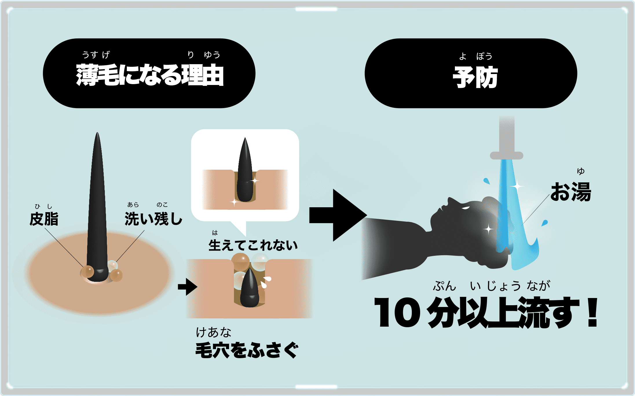 薄毛対策の図解