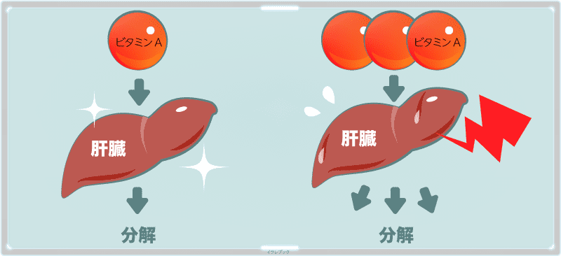 ビタミンAが多すぎると頑張りすぎて肝臓が故障する